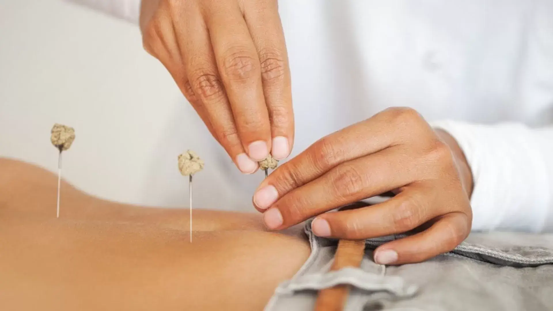 The Role of Acupuncture in Boosting Sperm Motility and Count